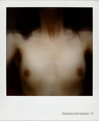 Polanoid