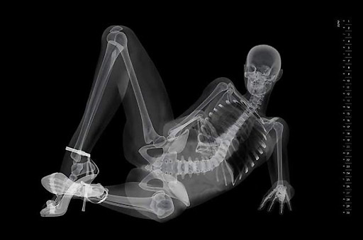 X-Ray Pin-up Calendar